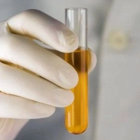 Viêm Đường Tiểu: Dấu Hiệu, Nguy Cơ Và Cách Điều Trị