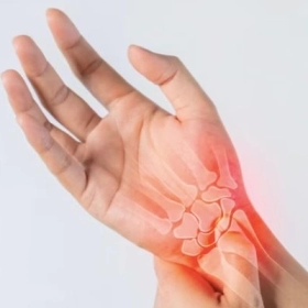 Viêm Khớp Cổ Tay: Nguyên Nhân, Triệu Chứng Và Cách Điều Trị