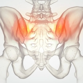 Viêm Khớp Cùng Chậu: Nguyên Nhân, Triệu Chứng Và Cách Điều Trị