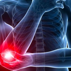 Viêm Khớp Khuỷu Tay: Nguyên Nhân, Triệu Chứng Và Cách Điều Trị