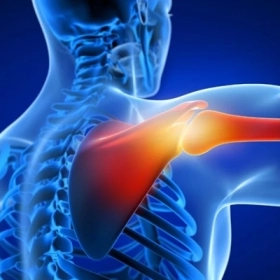 Viêm Khớp Quanh Vai: Nguyên Nhân, Triệu Chứng Và Cách Điều Trị