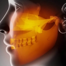 Viêm Khớp Thái Dương Hàm: Nguyên Nhân, Triệu Chứng Và Điều Trị