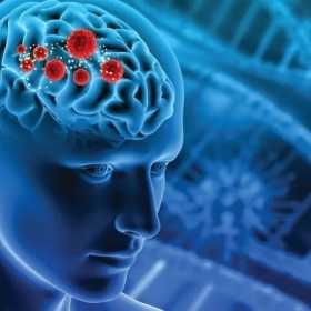 Viêm màng não lympho bào: Dấu hiệu, nguyên nhân và điều trị