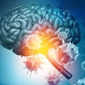 Viêm não tự miễn: Triệu chứng, nguyên nhân và cách điều trị