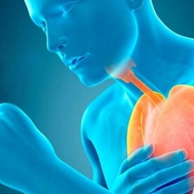 Viêm Phế Quản Là Gì? Nguyên Nhân, Triệu Chứng Và Cách Điều Trị Hiệu Quả