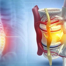 Viêm tủy cắt ngang: Dấu hiệu, nguyên nhân và lộ trình điều trị