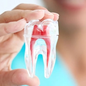 Viêm tủy răng Là Gì? Nguyên Nhân, Triệu Chứng Và Cách Điều Trị