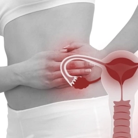 Viêm Vùng Chậu (PID): Dấu Hiệu Nhận Biết Và Hướng Xử Trí