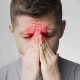 Viêm Xoang Trán Là Gì? Dấu Hiệu Nhận Biết Và Cách Điều Trị