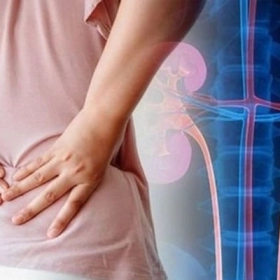 Vôi Hóa Thận Là Gì? Nguyên Nhân, Triệu Chứng Và Cách Điều Trị