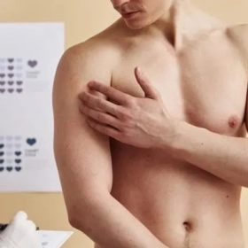 Vú To Ở Nam Giới Là Gì? Nguyên Nhân Và Cách Điều Trị Hiệu Quả