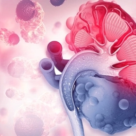 Xốp tủy thận: Nguyên nhân, triệu chứng và giải pháp điều trị