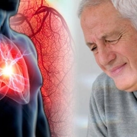 Xuất Huyết Phế Nang Lan Tỏa Là Gì? Dấu Hiệu Và Cách Điều Trị
